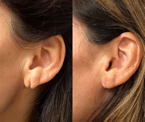 Enter the length or pattern for better results. . Ear lobe nyt